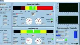 Developing an Automated Anesthesia System Using NI LabVIEW Software