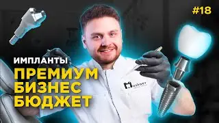 Зубной разгон №18 Импланты. Как выбрать: Бюджет или Premium?