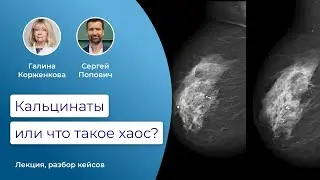 Кальцинаты или что такое хаос? - вебинар с участием проф. Галины Корженковой