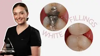 Why Should You Consider Changing To White Fillings?