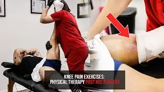 Physical Rehab After ACL Knee Reconstruction Surgery | Phil Daru