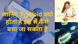 typhoid fever !जानें  टाइफाइड बुखार  के,कारण,लक्षण