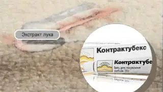 Контрактубекс