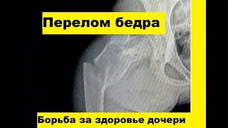 Патологический перелом бедра