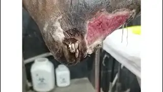 Worms crawl out of a patient’s foot | Maggots