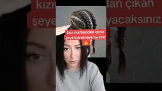 kızın kafasından çıkan ŞEYE inanamayacaksınız! 😱🕷 