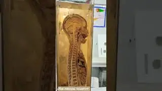 Different Body parts 🦵💪🧠🫀🫁 - Science exhibition 