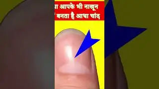 Anguthe Par Chand Ka Nishan | Anguthe Mein Chand Ka Nishan | Anguthe Mein Chandrama Ka Nishan #short