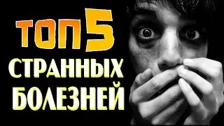 Самые СТРАННЫЕ болезни, о которых Вы не знали.