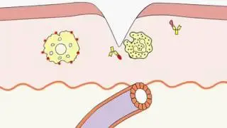 General overview of the immune response