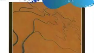 Fotocoagulação a laser parte 02 de 03.
