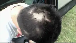 Wee Clippers - Jackass: The Movie