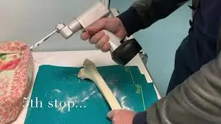 SAW MALFUNCTION