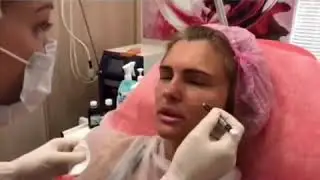 Контурная пластика в клинике Аура