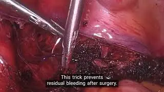 Copy of COR 435 092024 Hysterectomy