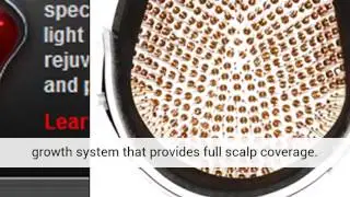 igrow laser hair rejuvenation