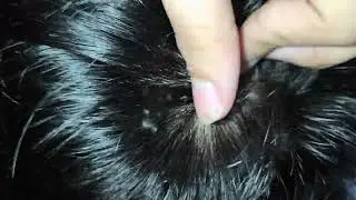 NAKALMOT AKO NG PUSA SA ULO