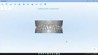 5. UP3D - How to start an Orthodontics order?