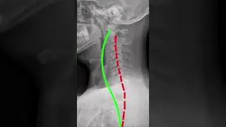 Now these are nice curves! 😍 