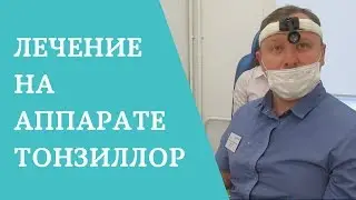 Лечение тонзиллита на аппарате 