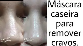 Máscara caseira para remover cravos, #facavocemesmo