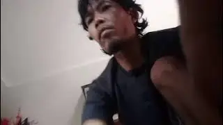 Baru Jatuh Dari Motor Badanya Langsung Di Serfis