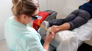 Лечение пяточной шпоры