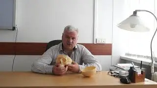 Метод МРТ головного мозга