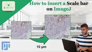 How to insert a SCALE BAR on ImageJ #sclalebar #imagej #tutorial