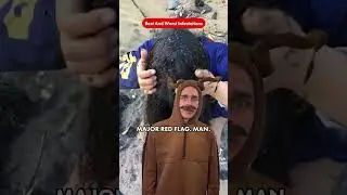Bugs! Gross! Worst Lice Infestations Ever!
