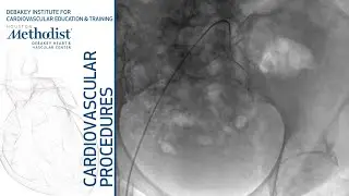 Diagnostic Angiogram (Maham Rahimi, MD, Yusuf Chauhan, MD)
