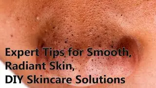Clearing Blackheads on Nose: Expert Tips for Smooth, Radiant Skin | DIY Skincare Solutions
