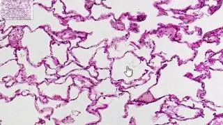 Alveoli