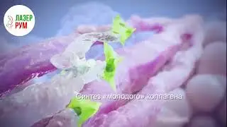 SMAS - лифтинг