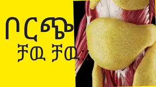ቦርጭን ለመቀነስ ይህን አድርጉ።/አስገራሚ ለዉጥ።