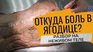 Седалищный нерв | Глубокая БОЛЬ в ягодице | разбор: НЕЖИВОЕ тело