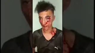 #xiyonat