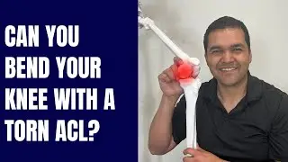 Can You Bend Your Knee With a Torn ACL?