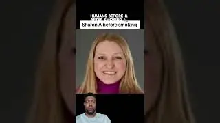 Humans Before and After Smoking. Side Effects They don't want you to see. Must Watch!!