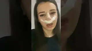 Burun ameliyatından sonraki 1. gün