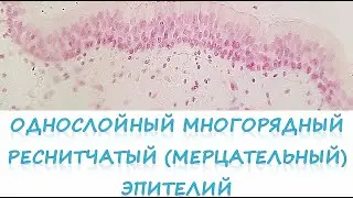 Однослойный многорядный реснитчатый эпителий