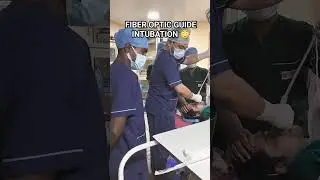 FIBER OPTIC GUIDE INTUBATION 😳 #doctor #medical #viral #youtubeshorts