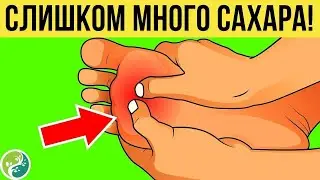 8 Предупреждающих Признаков Того, Что Вы Едите Слишком Много Сахара
