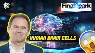 Swiss tech firm launches AI made of human brain cells rental service