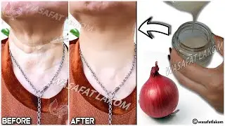 1 onion is a million times stronger than Botox,🧅 it eliminates wrinkles and fine lines instantly
