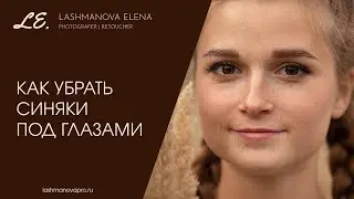 Как убрать синяки под глазами