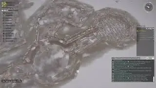the problem with infantry in foxhole