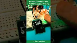 🤯Heartbeat Monitoring using Arduino Uno and ECG Sensor #diyelectronics #arduino #ecg #projects