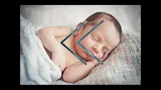 Reverse - How To Basic - How To Quickly Deliver a Baby