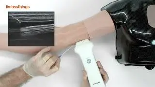 TruPICC IV Training Arm Demo